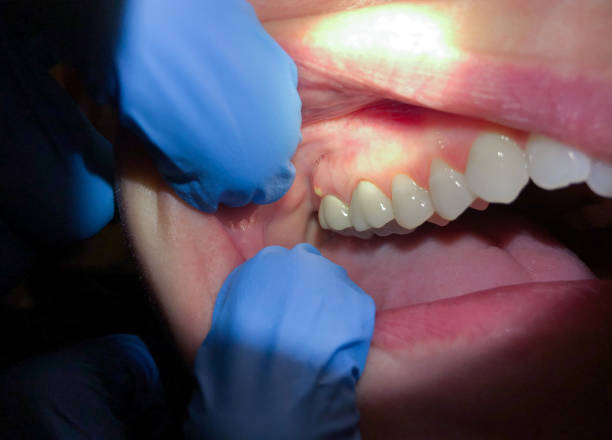 Best Urgent Dental Care for Toothache in Burnham, IL